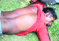 Devi Lal, who was allegedly beaten up by security guards manning GADVAU campus, in Ludhiana