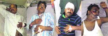The victims who sustained serious injuries in an accident near Jalandhar on Tuesday