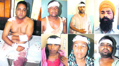 Some of the residents of Basala village, near Jalandhar Cantonment, who were injured in a clash between two groups of villagers on Thursday.