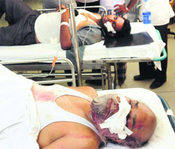 Injured passengers being treated at the DMCH in Ludhiana on Friday. 