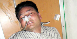 Jaspal SIngh, who was critically injured in the incident , admitted to a hospital.