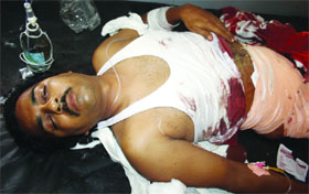 The injured get treatment at a hospital.