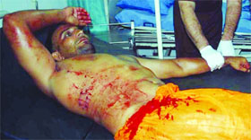 The injured get treatment at a hospital.