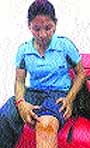 Sangeeta Rankoti shows her knee injury