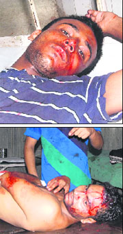 Youths, injured in a bloody clash between two groups, undergo treatment at the Civil Hospital in Jalandhar