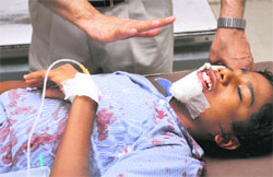 Injured student Rakesh who had to wait for over 20 minutes for the X-Ray at GMSH-16 on Friday.