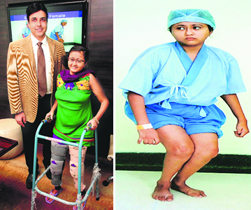 Simran with Dr Manuj Wadhwa after surgery; and (right) before surgery.