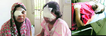  From left: Acid attack victims Hem Lata, Parkash and his wife, Samoora Devi, in the Trauma Centre at Rewari on Thursday. 