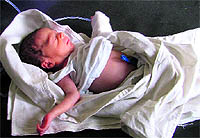 A file photo of the infant who was rescued from Sirhind canal near Sudhar