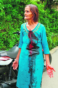 A woman injured in a group clash after a party organised by the NSUI in Dharamsala on Friday.