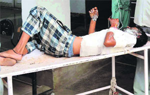 The victim, Shivram, under treatment at a hospital on Thursday. 