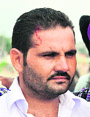 Kuldeep Singh who suffered a minor injury during the use of police force