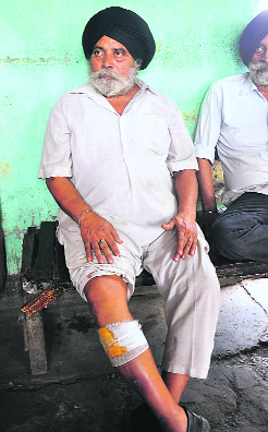 Parmar Singh, who was injured in police lathicharge, in Jammu on Friday.