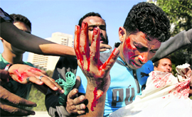 Protesters help a man injured in clashes on the road leading to the US embassy, near Tahrir Square in Cairo on Friday.