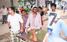 One of the injured at the GMCH-16 in Chandigarh on Monday. 