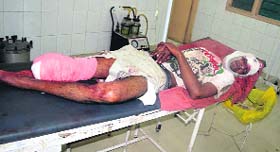 Munna, who jumped before a train, undergoes treatment at the Civil Hospital in Ludhiana on Monday.