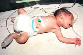 The newborn baby found dumped in a bag on the roof of an abandoned house at Suchan village in Sirsa.