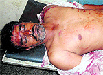 Jaswant, who sustained serious injuries in the attack