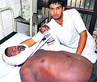 One of the injured at a city hospital