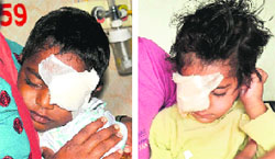 Six-year-old Prince and a three-year-old girl admitted to the PGI. Tribune photo: Pradeep Tewari
