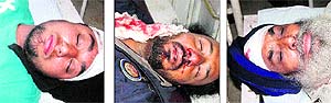 Some of the injured persons admitted in Civil Hospital Jalandhar on Sunday