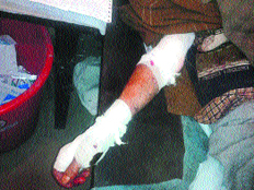 Ghulam Muhammed lying on a hospital bed in Srinagar after he was mauled by a pack of dogs in Kunzar Tangmarg.