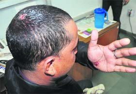 Ashok Kumar shows his injuries