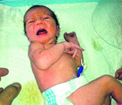 A baby girl found abandoned at the GB Pant Hospital in Srinagar.