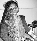 Sangeeta under treatment at the PGIMS, Rohtak