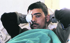18-year-old Tariq Ahmad Gujjari of Baramulla admitted in SMHS Hospital, Srinagar