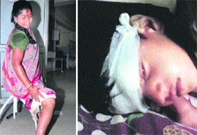Residents of Jalandhar who have been bitten by stray dogs recuperate in various hospitals.