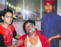 Sham at the Guru Nanak Dev Hospital in Amritsar on Friday. photo: Vishal Kumar