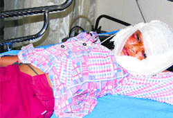 Subhash Yadav, who was mauled by a dog, in the hospital in Bathinda on Monday. 