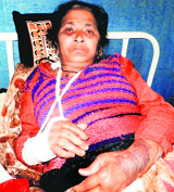 Injured arms of the woman.
