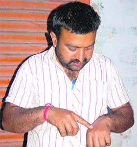 Scrap dealer Dinesh Kumar showing his injuries