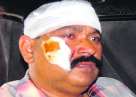 The injured auto-rickshaw driver in Jalandhar on Tuesday