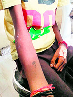The 14-year-old boy with tattooed arm in Amritsar