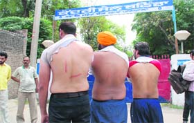 Unemployed linesmen showing injury marks outside the jail