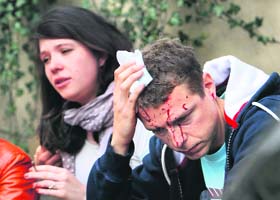 An injured man tends to his wounds after an explosion in Prague on Monday