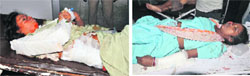 The injured being treated at the General Hospital, Sector 6, Panchkula, on Friday. Tribune photos: Nitin Mittal