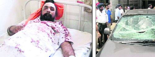 (From left) Akali leader PS Sohal, who was attacked in Qadian, at a hospital in Amritsar on Friday; and a car damaged in the attack. 