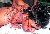 One of the persons who got injured in a clash in cantonment admitted to the Civil Hospital in Jalandhar on Wednesday