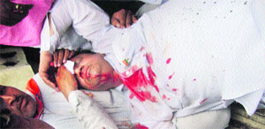 District BJP president Kamal Gupta bleeds profusely.