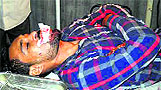 An injured Gurjit Singh; and (right) Daljit Singh at the Civil Hospital in Samrala on Wednesday