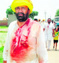 An injured supporter of a candidate in Uboke village in Tarn Taran.