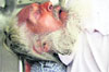 Gurmel Singh of Maherna Khurad injured in an attack on Wednesday. A Tribune Photograph