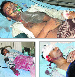 The injured in GND Hospital in Amritsar on Tuesday. 