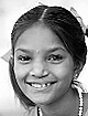 A child with cleft lip; and (right) Pinki after surgery