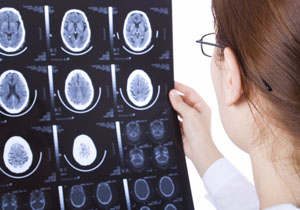 The differences between the left-brain and right-brain thinking determine how a person will go about solving a problem.  Thinkstockphotos