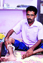 Ashwani Kumar, who was bitten by a rabid dog, awaits treatment